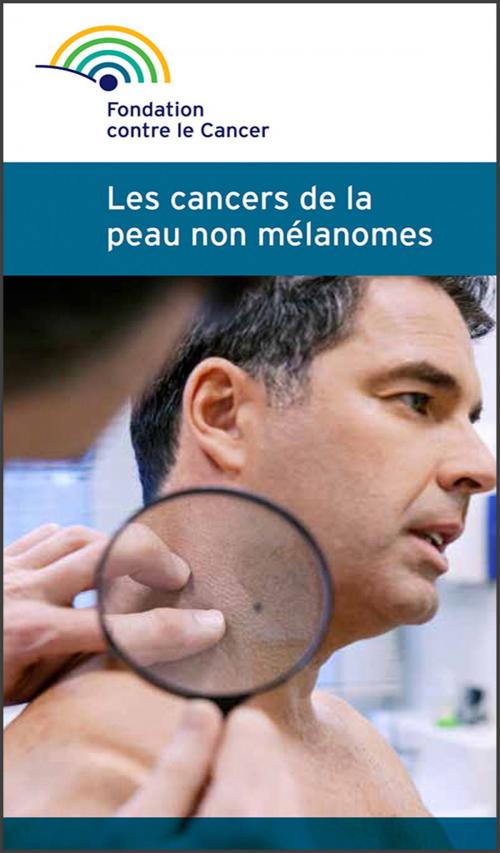 Cover of the book Les cancers de la peau non mélanomes by Fondation contre le cancer, Fondation contre le Cancer / Stichting tegen Kanker