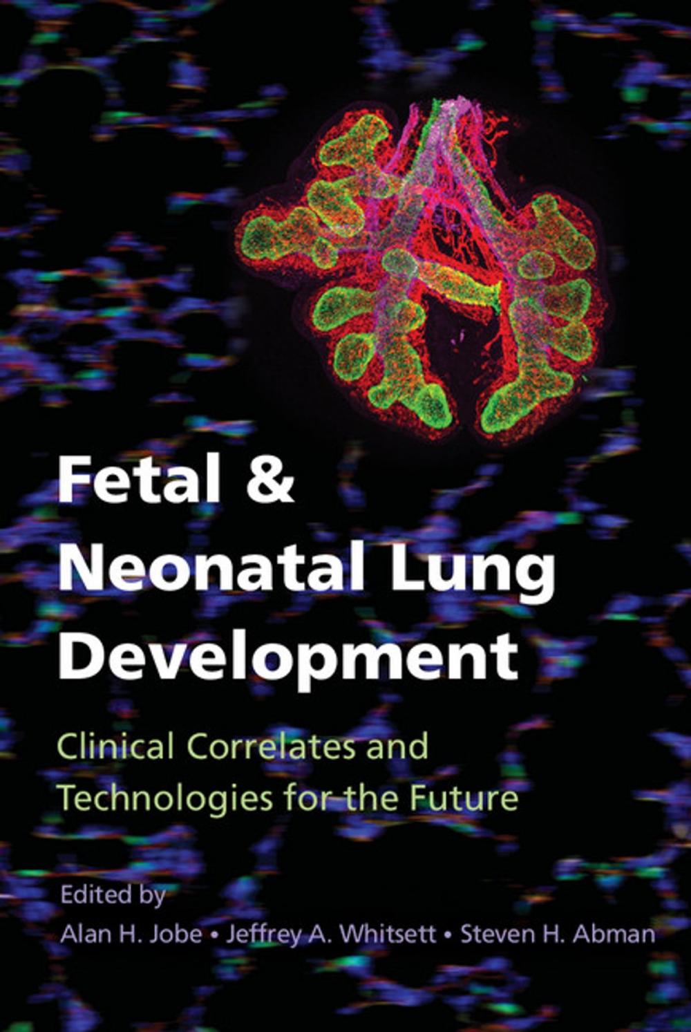 Big bigCover of Fetal and Neonatal Lung Development