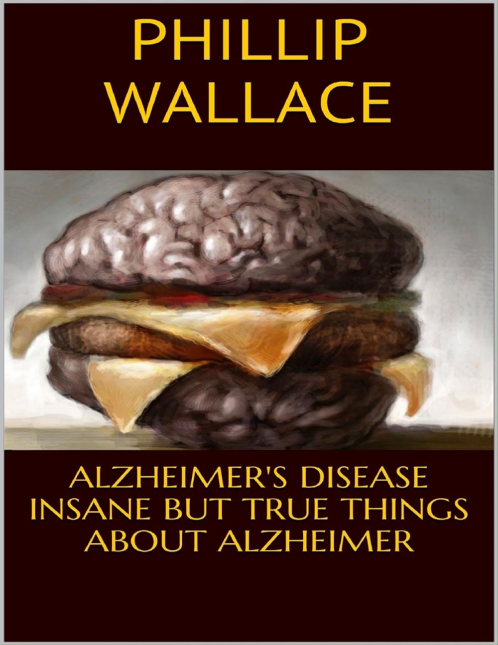 Big bigCover of Alzheimer's Disease: Insane But True Things About Alzheimer