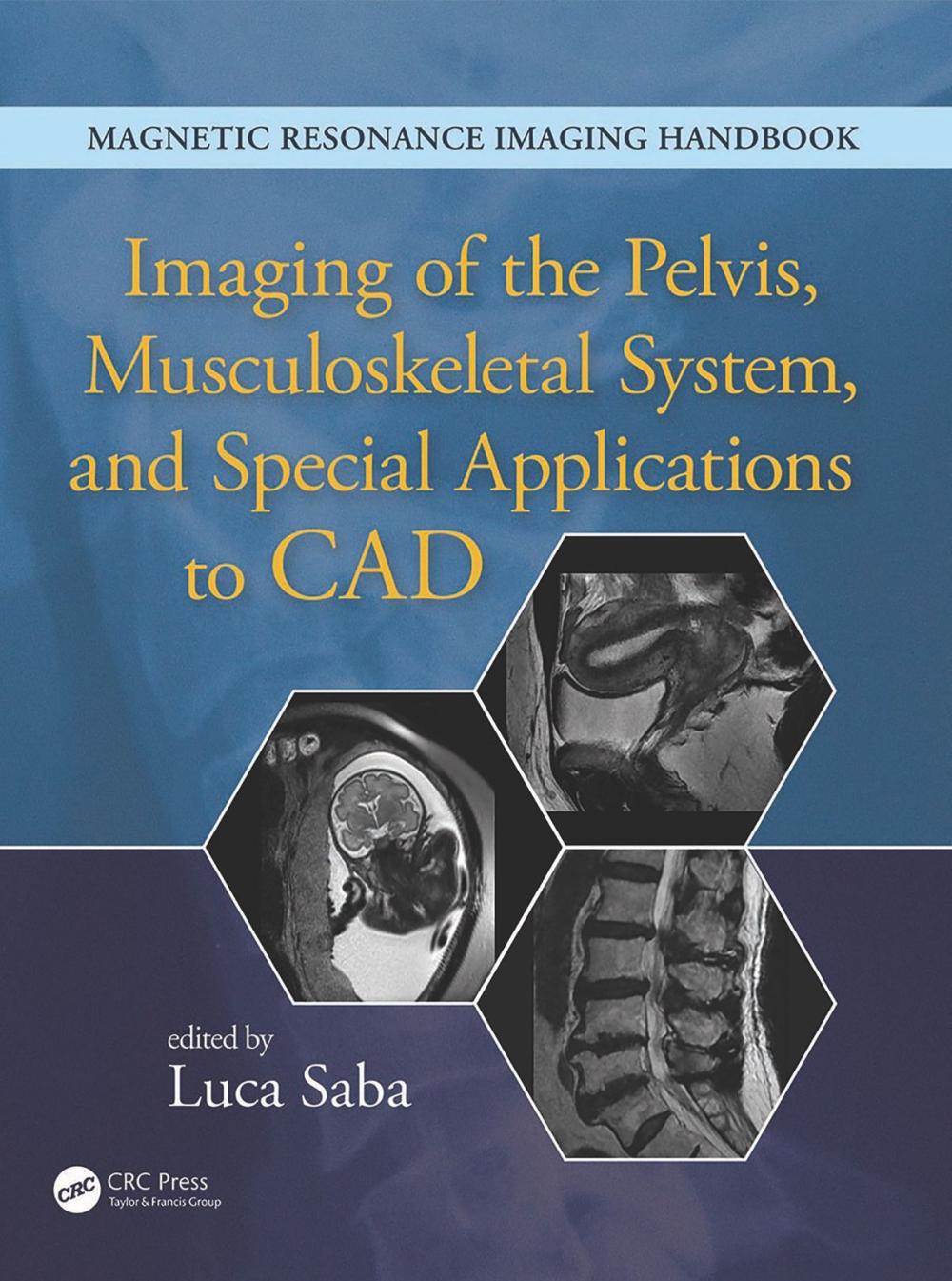 Big bigCover of Imaging of the Pelvis, Musculoskeletal System, and Special Applications to CAD