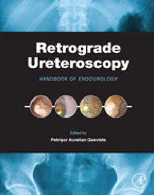Cover of the book Retrograde Ureteroscopy by PK Gupta