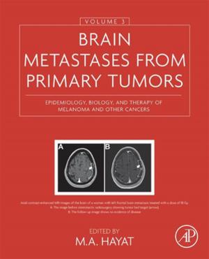 Cover of the book Brain Metastases from Primary Tumors, Volume 3 by Russell J. Crawford, Elena P. Ivanova