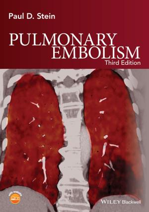 Cover of the book Pulmonary Embolism by William Panek