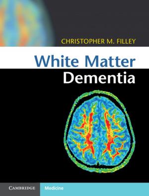 Cover of the book White Matter Dementia by Christopher H. Hawkes, Richard L. Doty