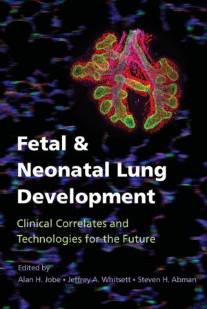 Cover of the book Fetal and Neonatal Lung Development by Terry L. Deibel