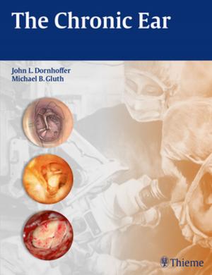 Cover of the book The Chronic Ear by Heinz Lüllmann, Klaus Mohr, Lutz Hein