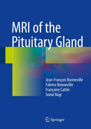 Cover of the book MRI of the Pituitary Gland by Lucy Ferguson