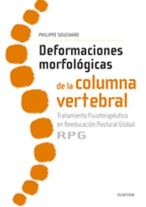 Cover of the book Deformaciones morfológicas de la columna vertebral by 