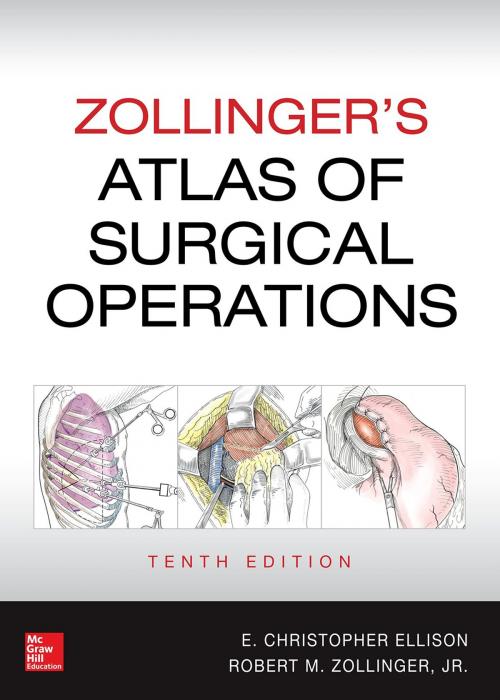 Cover of the book Zollinger's Atlas of Surgical Operations, 10th edition by E. Christopher Ellison, Robert M. Zollinger Jr., McGraw-Hill Education