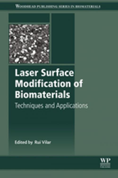 Cover of the book Laser Surface Modification of Biomaterials by , Elsevier Science