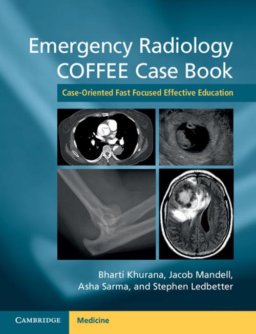 Cover of the book Emergency Radiology COFFEE Case Book by , Cambridge University Press