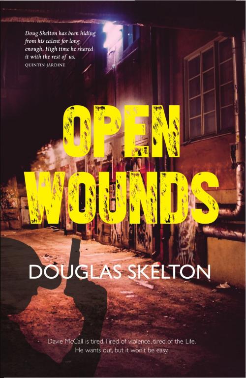 Cover of the book Open Wounds by Douglas Skelton, Luath Press Ltd