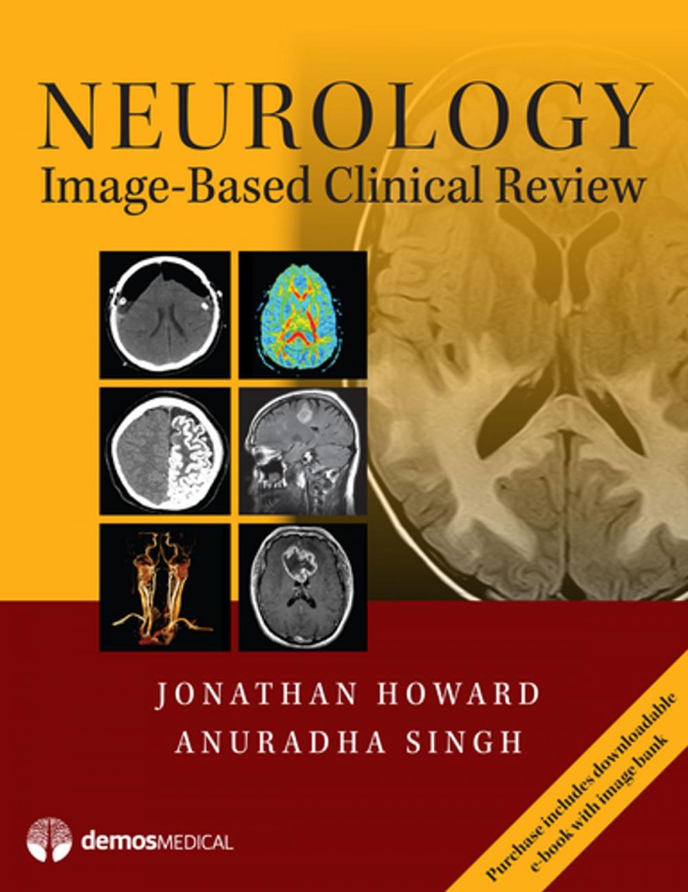 Big bigCover of Neurology Image-Based Clinical Review