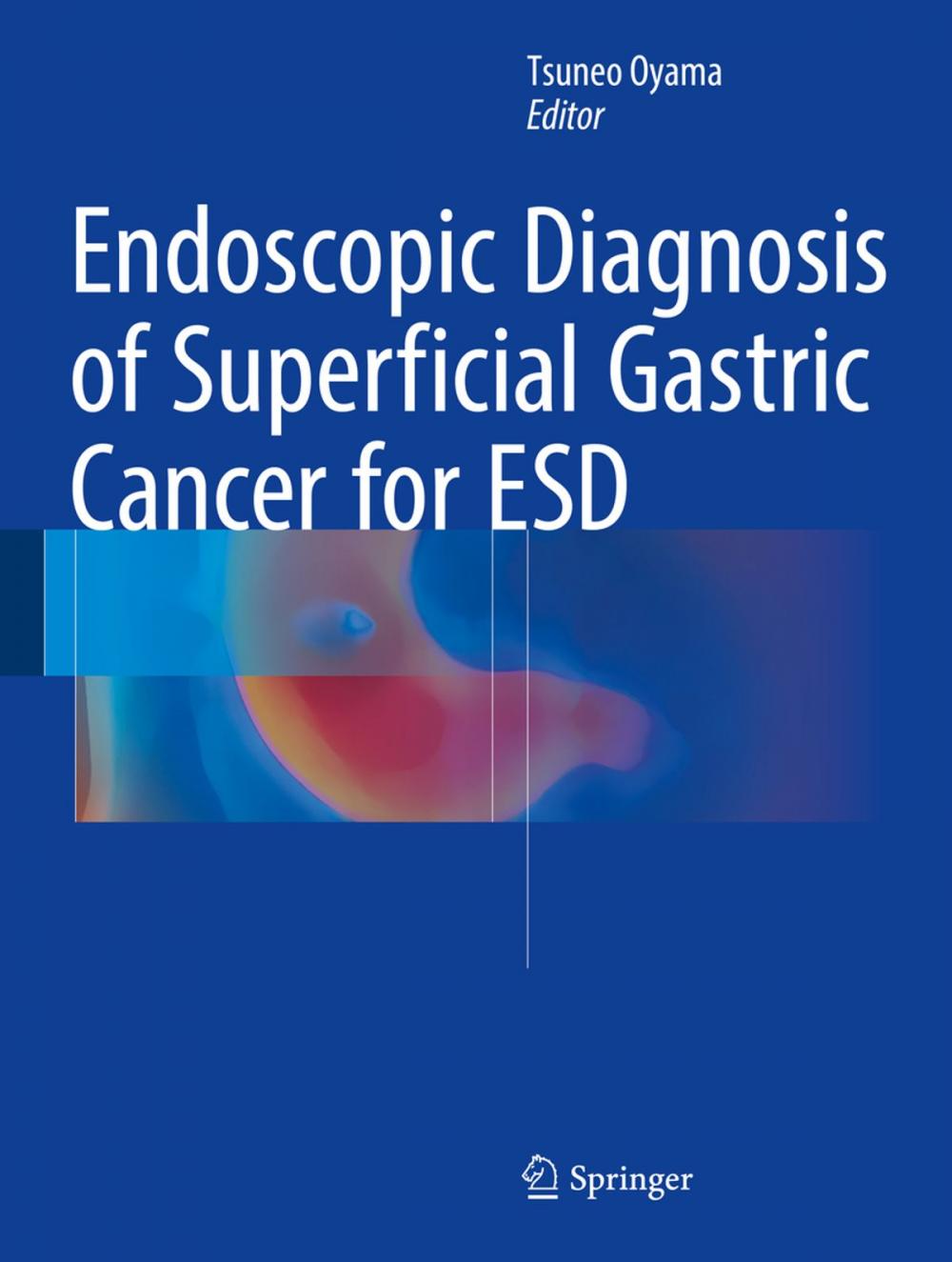 Big bigCover of Endoscopic Diagnosis of Superficial Gastric Cancer for ESD