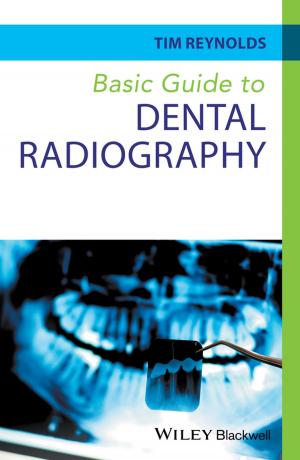 Cover of the book Basic Guide to Dental Radiography by William W. Priest, Steven D. Bleiberg, Michael A. Welhoelter