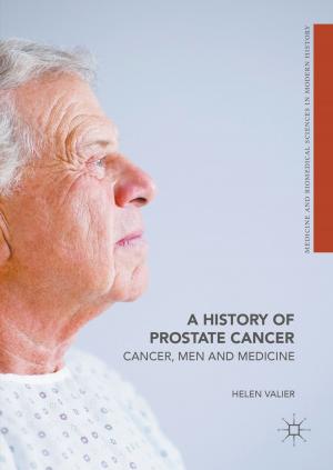 bigCover of the book A History of Prostate Cancer by 