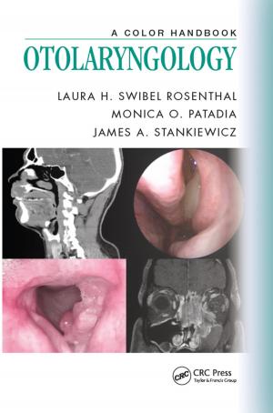 Cover of the book Otolaryngology by Patricia Hillebrandt, Will Hughes, John Murdoch