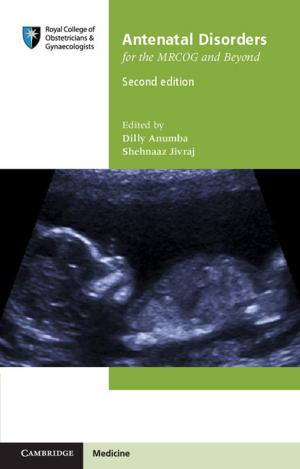 bigCover of the book Antenatal Disorders for the MRCOG and Beyond by 