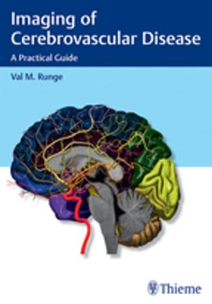 Cover of the book Imaging of Cerebrovascular Disease by Francoise Wilhelmi de Toledo, Hubert Hohler