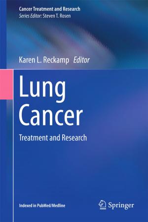 Cover of the book Lung Cancer by Sergio Chibbaro, Lamberto Rondoni, Angelo Vulpiani