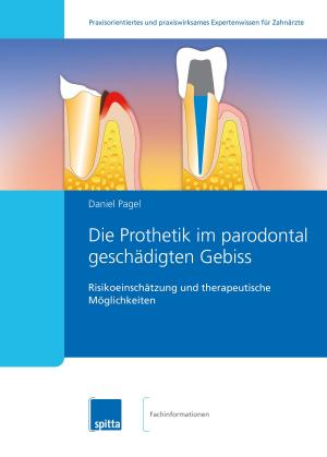 Cover of Die Prothetik im parodontal geschädigten Gebiss
