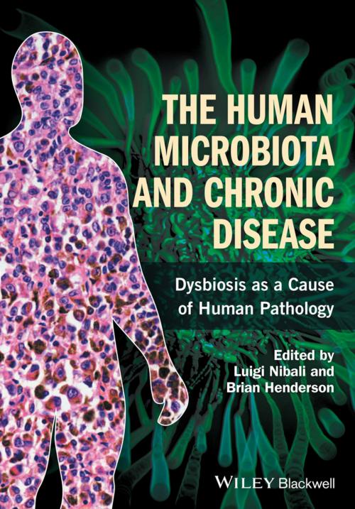 Cover of the book The Human Microbiota and Chronic Disease by , Wiley