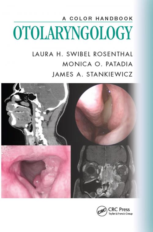 Cover of the book Otolaryngology by , CRC Press