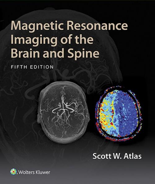 Cover of the book Magnetic Resonance Imaging of the Brain and Spine by Scott W. Atlas, Wolters Kluwer Health