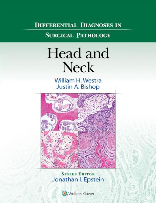 Cover of the book Differential Diagnoses in Surgical Pathology: Head and Neck by William H. Westra, Justin Bishop, Wolters Kluwer Health