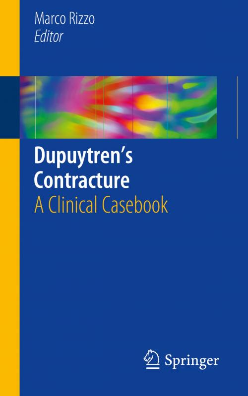 Cover of the book Dupuytren’s Contracture by , Springer International Publishing