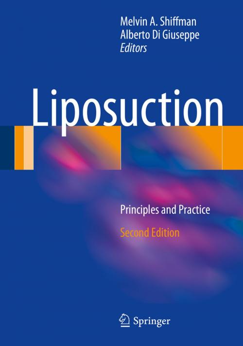 Cover of the book Liposuction by , Springer Berlin Heidelberg