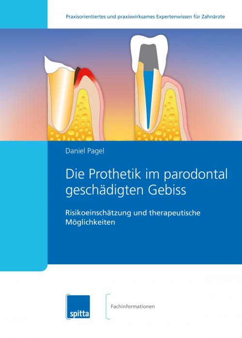 Cover of the book Die Prothetik im parodontal geschädigten Gebiss by Daniel Pagel, Spitta