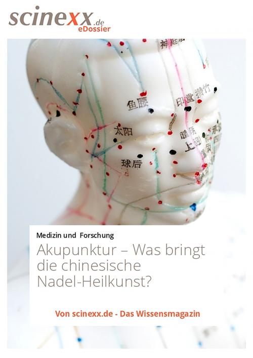 Cover of the book Akupunktur by Nadja Podbregar, YOUPublish