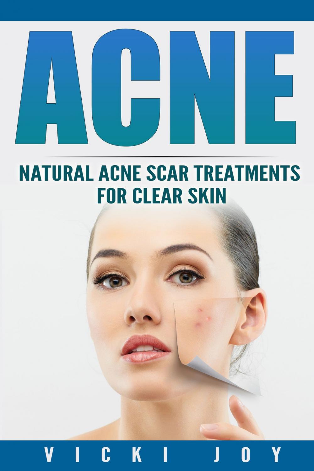 Big bigCover of ACNE