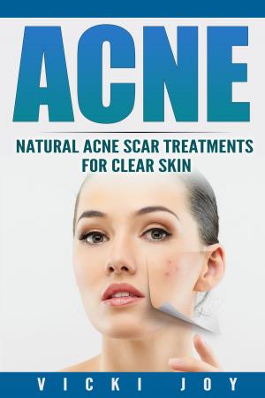 Book cover of ACNE
