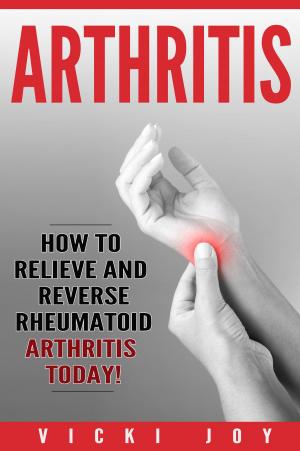 Cover of the book ARTHRITIS by George T. Grossberg, M.D., Barry Fox