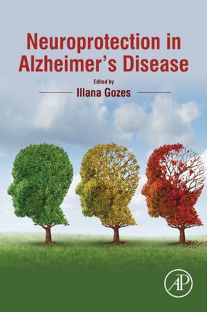 Cover of the book Neuroprotection in Alzheimer's Disease by Nick Milton
