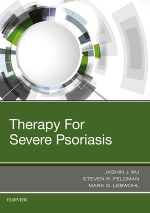 Book cover of Therapy for Severe Psoriasis E-Book