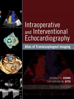 Cover of the book Intraoperative and Interventional Echocardiography by Margaret Barnes, PhD, RM, RN, Jennifer Rowe, PhD, MPhil, Grad Dip Ed (Nurs), BA, Dip Ed, RN