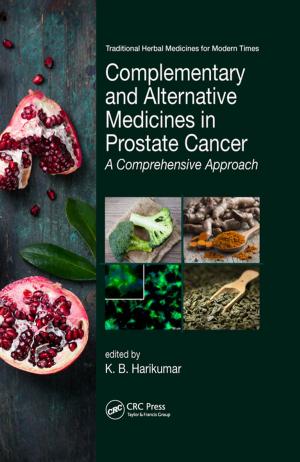 Cover of the book Complementary and Alternative Medicines in Prostate Cancer by Paul M. Salmon, Neville A. Stanton, Michael Lenné, Daniel P. Jenkins, Laura Rafferty, Guy H. Walker