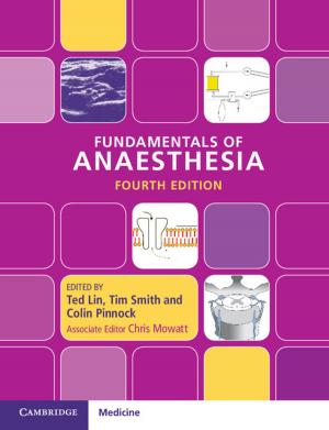 Cover of the book Fundamentals of Anaesthesia by Paul Mitchell