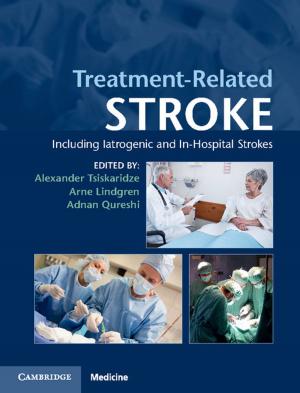Cover of the book Treatment-Related Stroke by Thomas S. Stroik, Michael T. Putnam