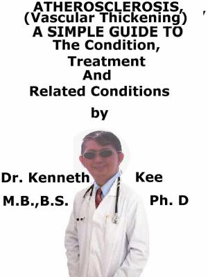 Cover of the book Atherosclerosis, (Vascular Thickening) A Simple Guide To The Condition, Treatment And Related Conditions by Kenneth Kee
