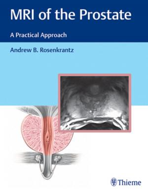 Cover of the book MRI of the Prostate by Michael B. Zimmermann