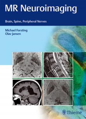 Cover of the book MR Neuroimaging by E. Sander Connolly, Guy M. McKhann II, Judy Huang