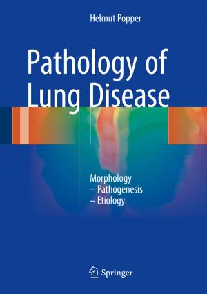 Cover of the book Pathology of Lung Disease by Uta Gaidys, Joachim Westenhöfer, Corinna Petersen-Ewert, Katrin Kern, Johanna Buchcik