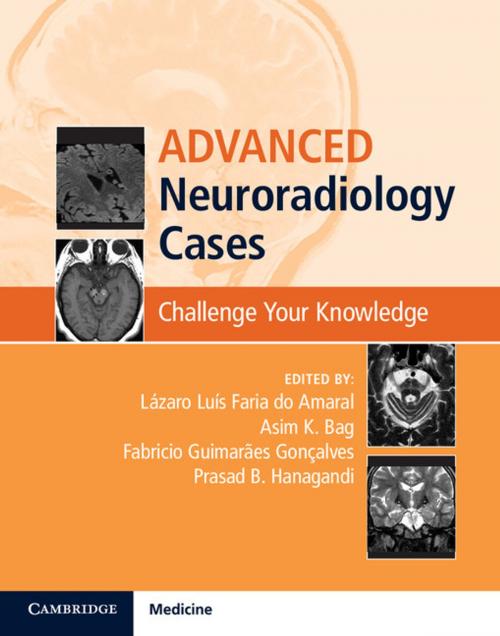 Cover of the book Advanced Neuroradiology Cases by Suzanne Byan-Parker, Cambridge University Press
