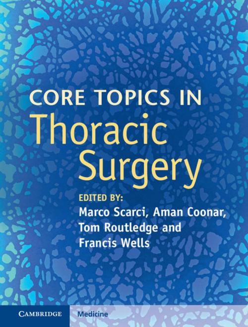 Cover of the book Core Topics in Thoracic Surgery by , Cambridge University Press
