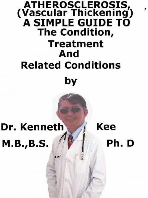 Cover of the book Atherosclerosis, (Vascular Thickening) A Simple Guide To The Condition, Treatment And Related Conditions by Kenneth Kee, Kenneth Kee
