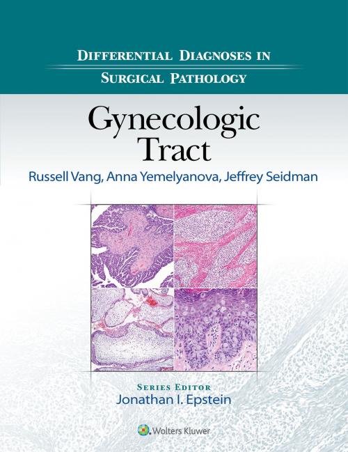 Cover of the book Differential Diagnoses in Surgical Pathology: Gynecologic Tract by Russell Vang, Yemelyanova, Anna, Jeffrey D. Seidman, Wolters Kluwer Health